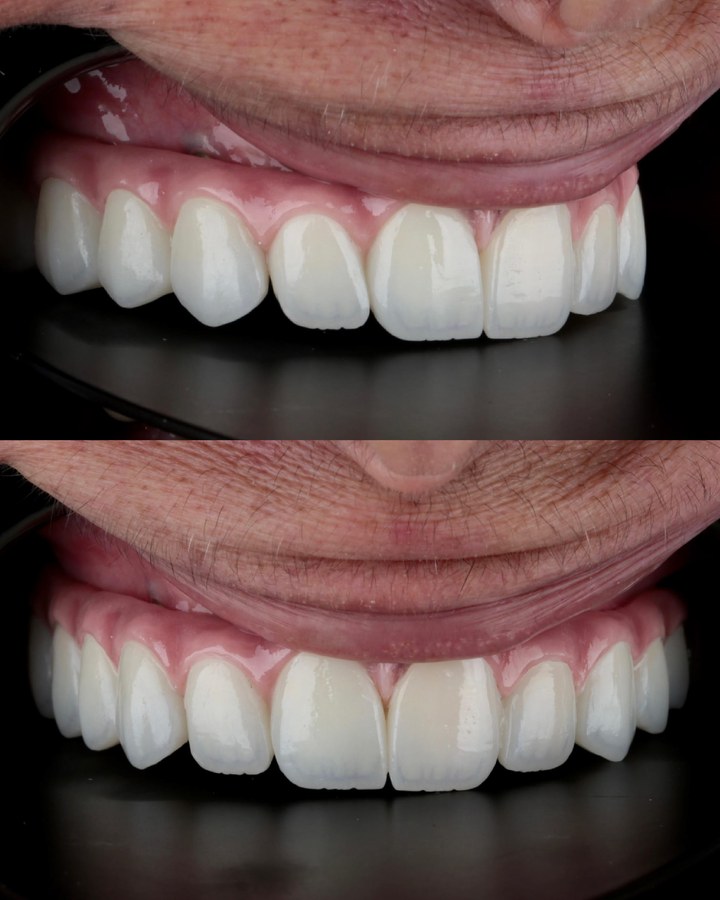 Before and after smile transformation 26