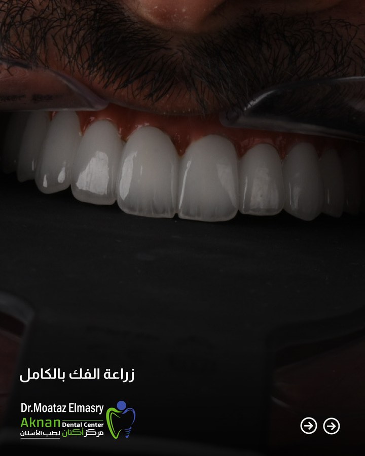 Before and after smile transformation 27