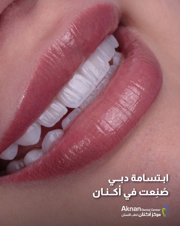 Before and after smile transformation 28