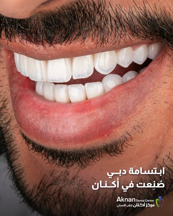 Before and after smile transformation 29