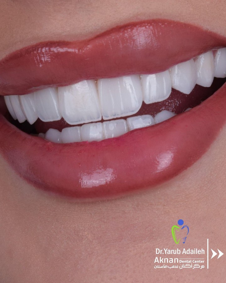 Before and after smile transformation 7